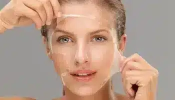 Tca Kimyasal Peeling Nedir